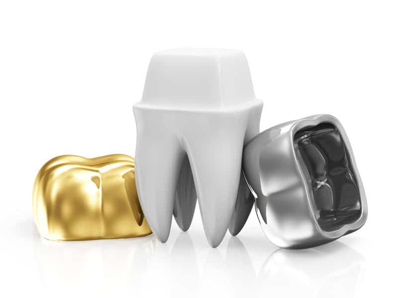 31692118 dental crowns with a tooth isolated on white background 31692118 dental crowns with a tooth isolated on white background