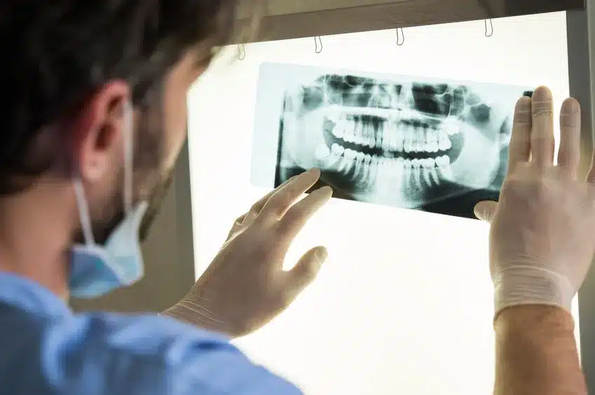 Dental Xrays Dental Xrays