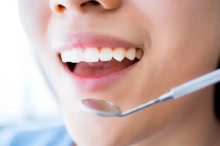 The Importance of Dental Exams The Importance of Dental Exams