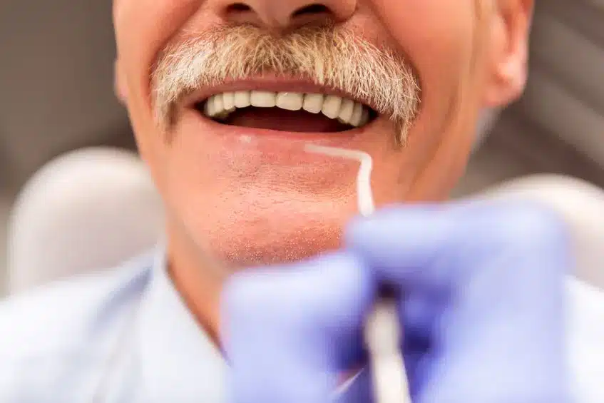 Types of Dentures