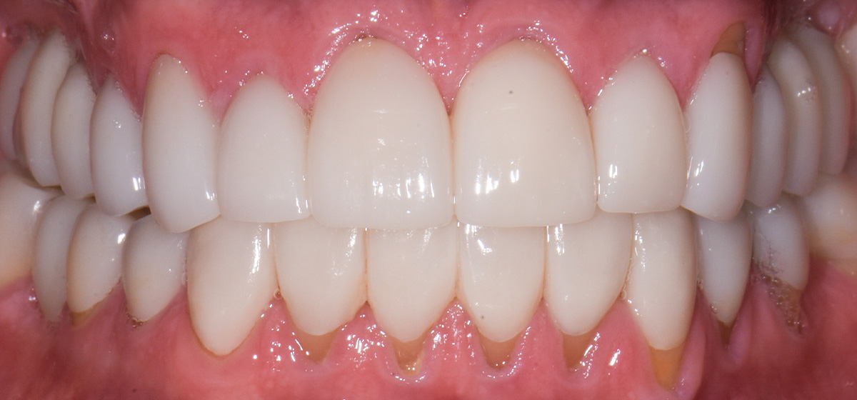 Case 16 After