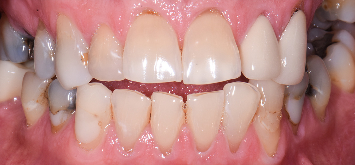 Case 16 Before