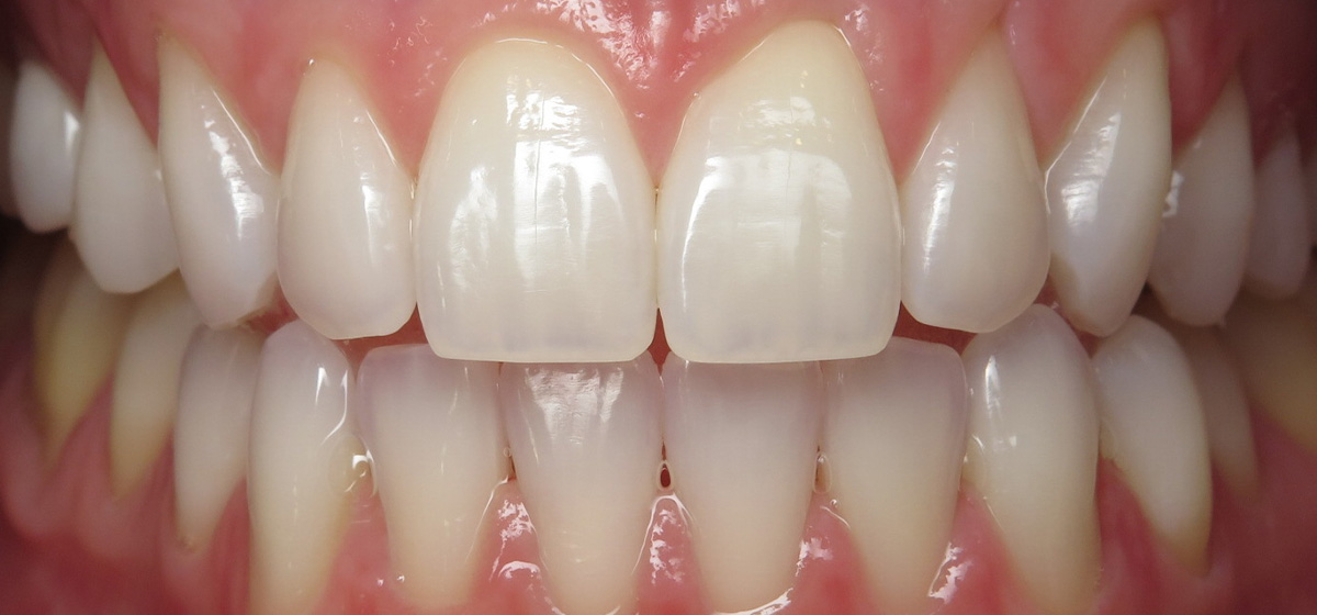 Case 7 After