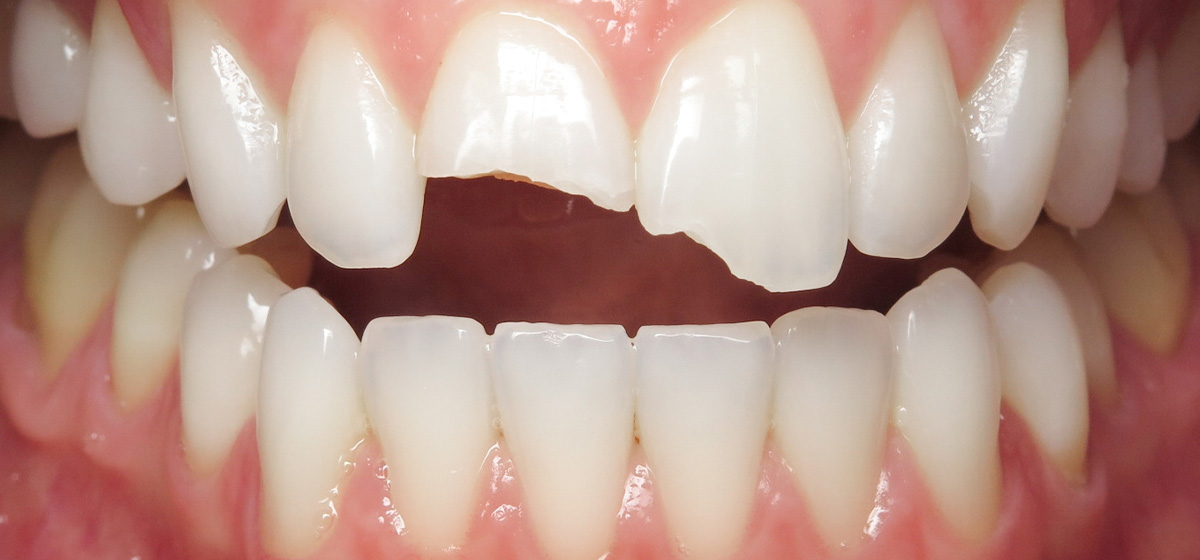Case 7 Before