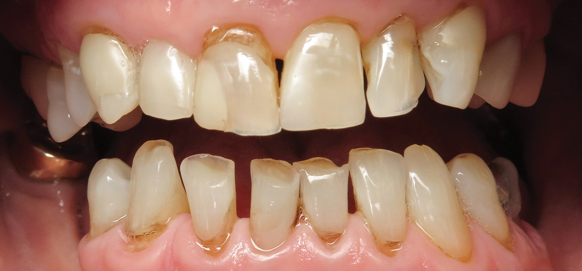 Advanced General Dentistry In Grandville Michigan