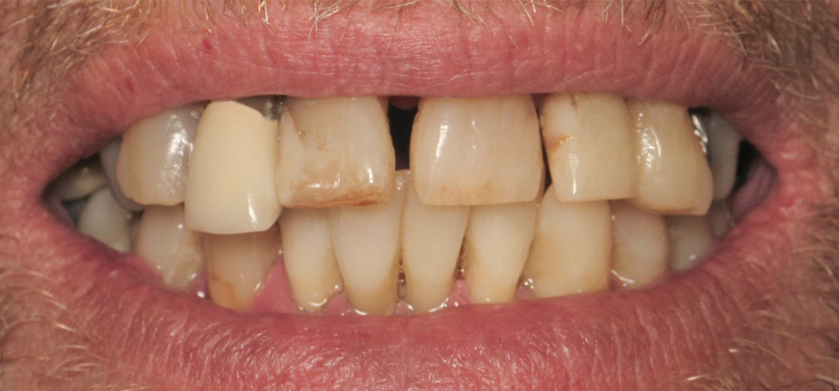 Advanced General Dentistry West Michigan