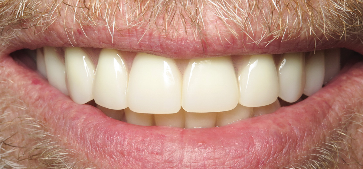 General Dentistry West Michigan