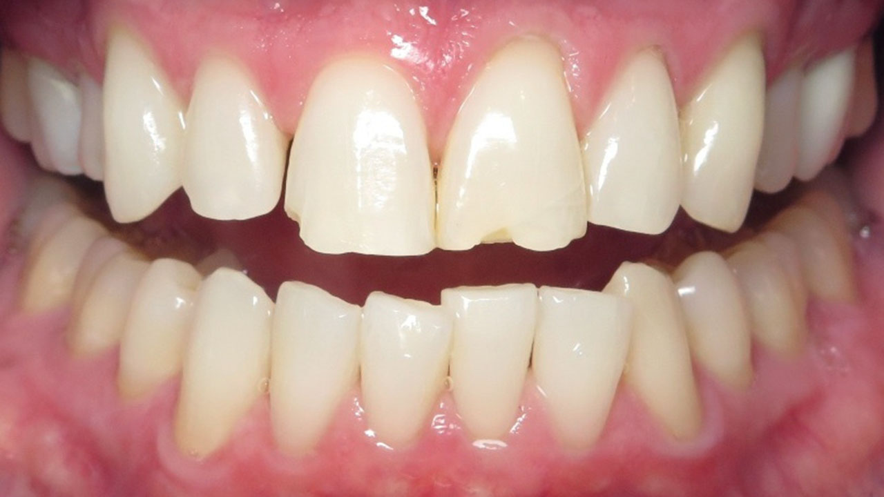 Grandville Mi Bonding Case Before Retracted