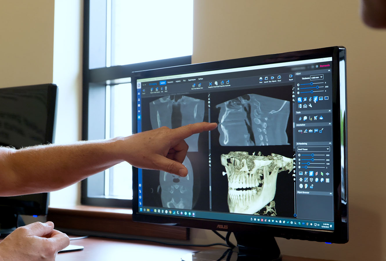 Sport Mouthguard Dentist West Michigan Sport Mouthguard Dentist West Michigan